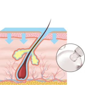 Regeneration Boost-Up