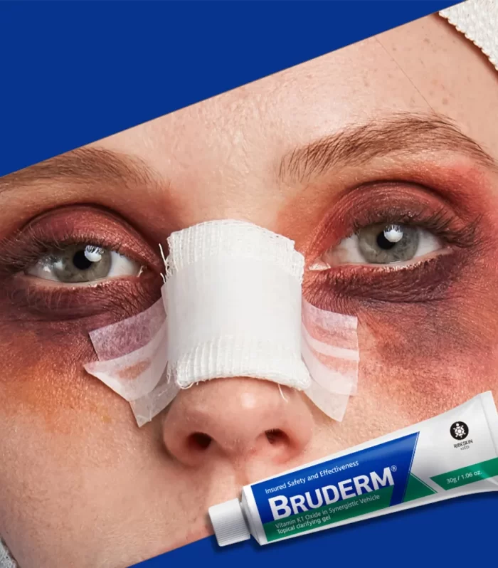 BRUDERM®  Advanced Bruise Recovery Cream