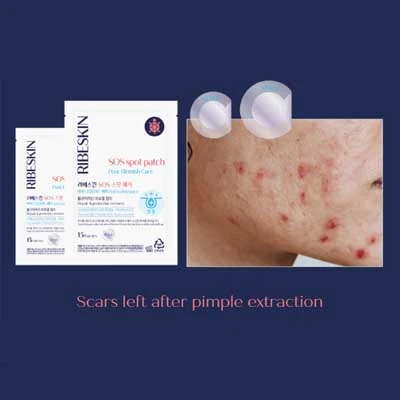 Hydrocolloid Patch